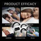 Anti Snore Nasal Dilatator